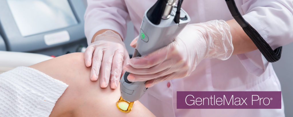 Technologie CANDELA MEDICAL pour des résultats optimaux durables